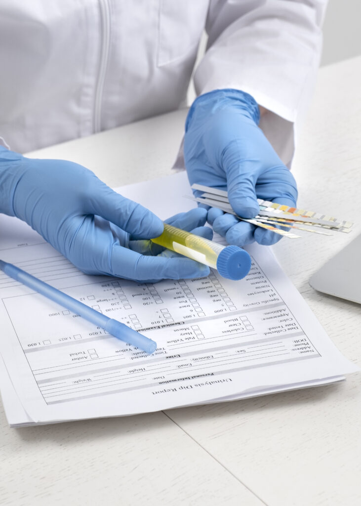 lab doctor performing medical exam urine (1)
